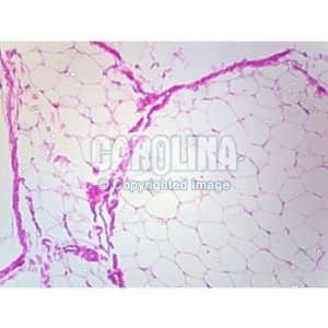 Mammal Adipose Tissue, sec. Microscope Slide, 10 u  