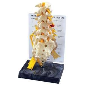   Anatomical Lumbar 5 Piece Vertebrae w/ Sacrum