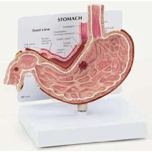  Stomach Model 
