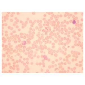   Education Histology Microscopic Slide Blood Smear, WR Stain; Human
