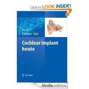 Cochlear Implant heute Arne Ernst, Rolf Dieter Battmer, Ingo Todt 