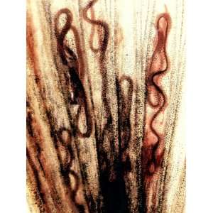  Nematode Worms, Philometroides, in a Fish Fin Photographic 