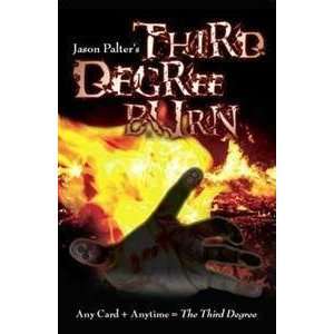  Third degree burn   Fire / Card / Street Magic Tri Toys & Games